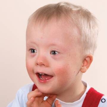 Special Needs Pediatric Dentistry in Jackson | Special Needs Dentist